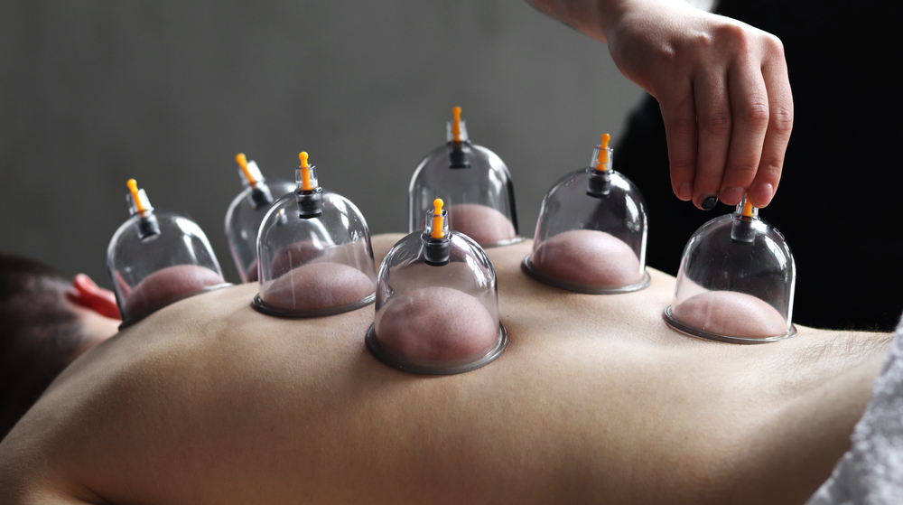 Cup,Massage,Close,Up.,Banks,For,Massage,On,The,Man’s