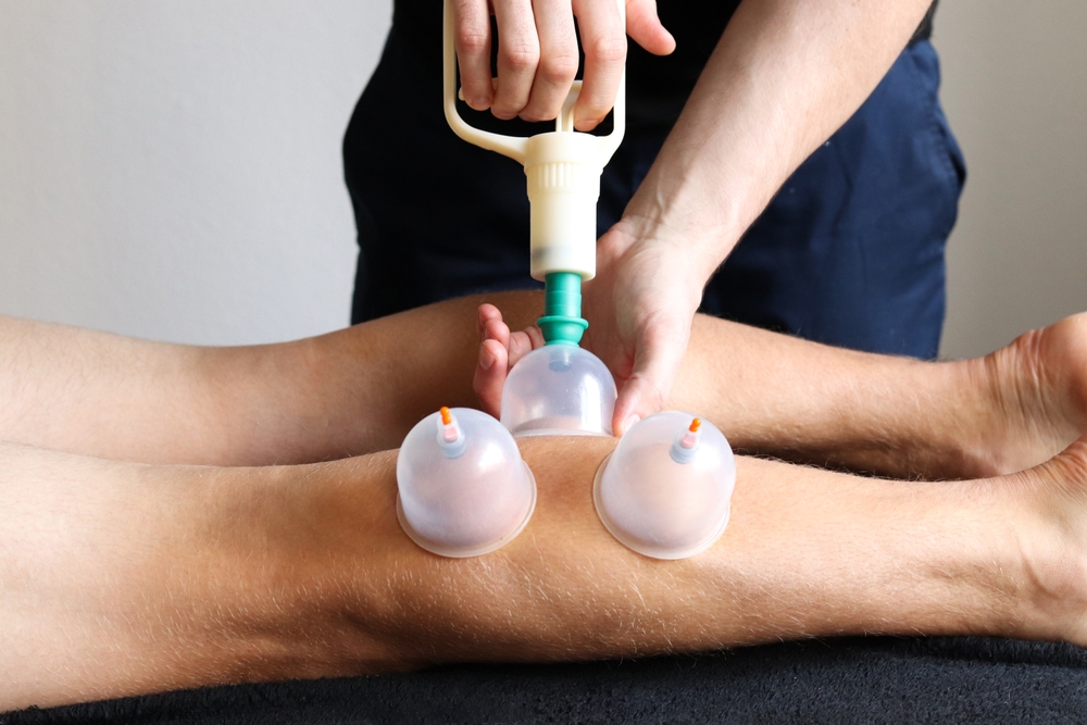 Cupping,Therapy.,Cup,Vacuum,Massage.,Cups,For,Massage,On,The